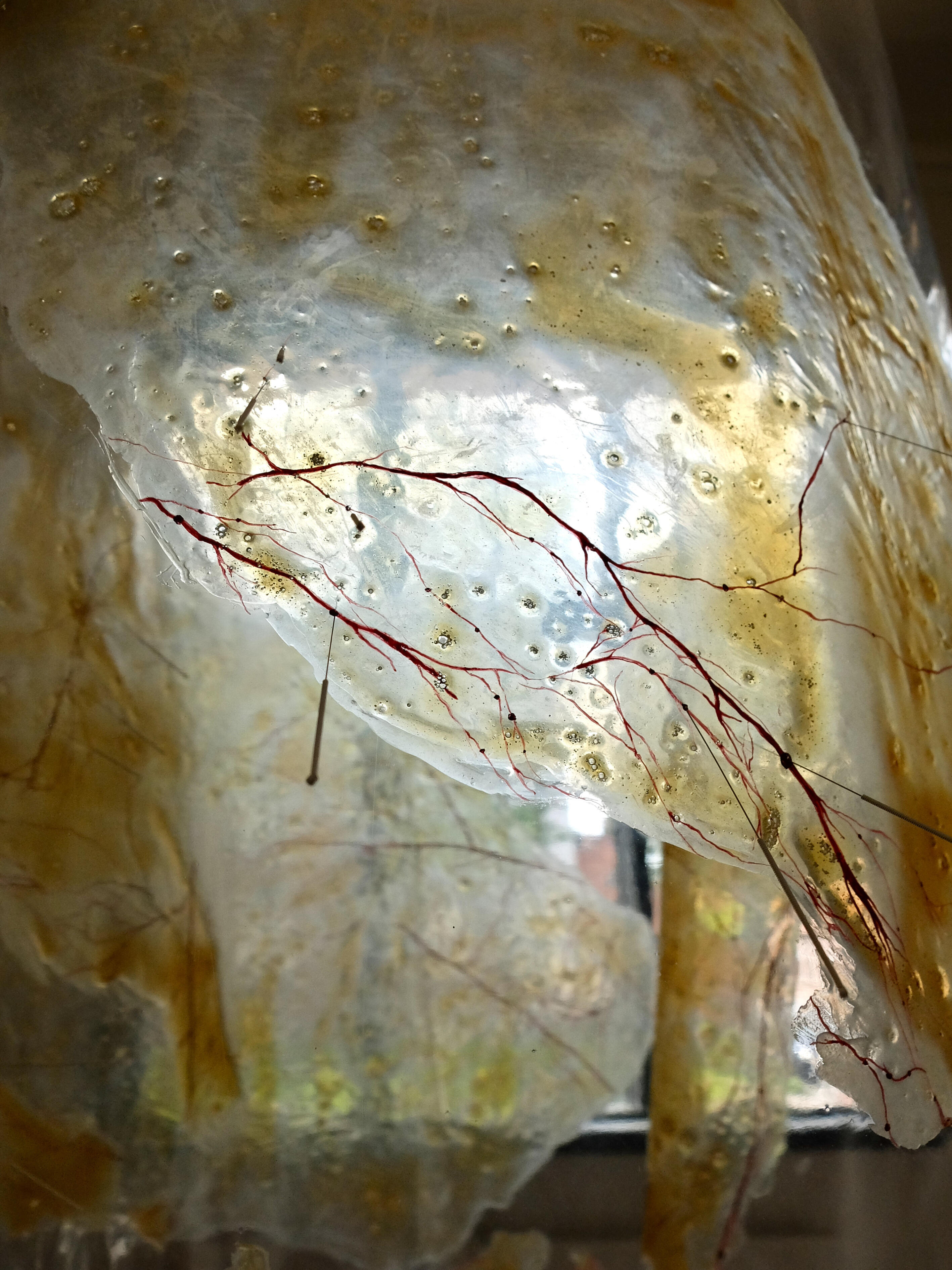 detail